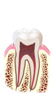Lečenje kanala korena zuba